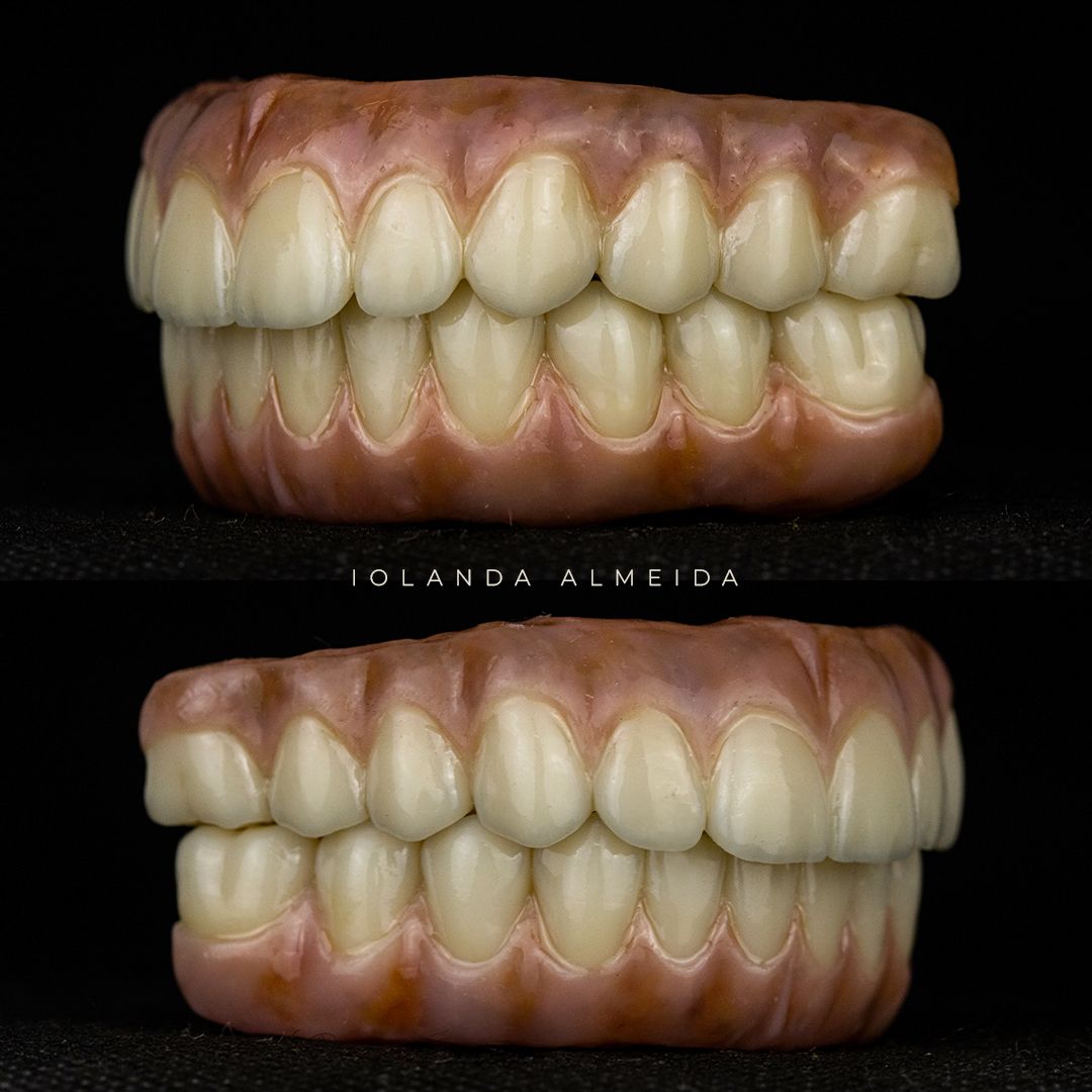 NextGen Dentistry: 3D Printing & Digital Solutions
